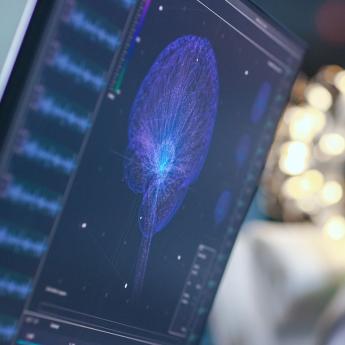 A man sleeps while his brain activity is monitored during a sleep research study